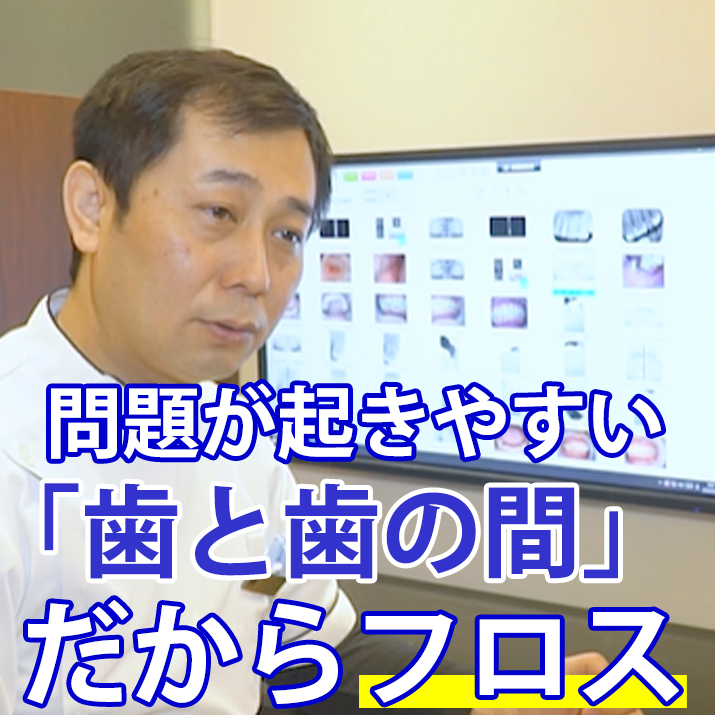 問題が起きやすい「歯と歯の間」だからフロス